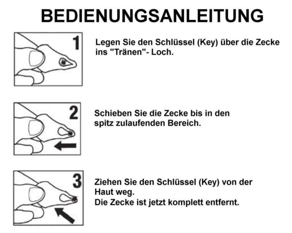 "Tick Key" Zeckenzange Zeckenentferner lila